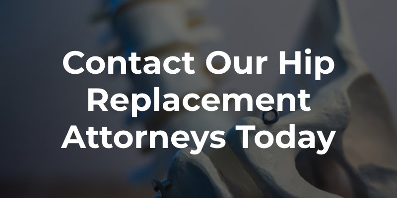 Contact Our Hip Replacement Attorneys Today