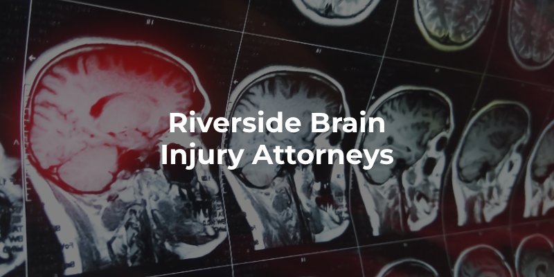 Riverside Brain Injury Attorneys